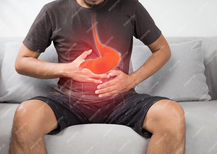Irritable Bowel Syndrome (IBS)